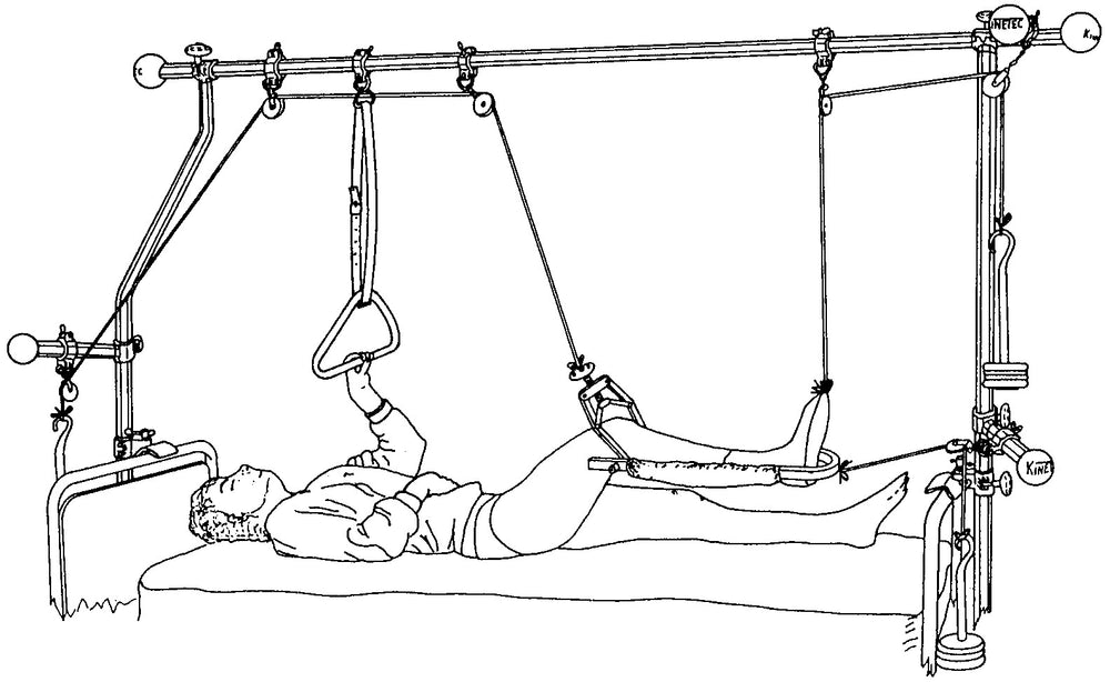 Splint 1050 with Pads (U Splint)