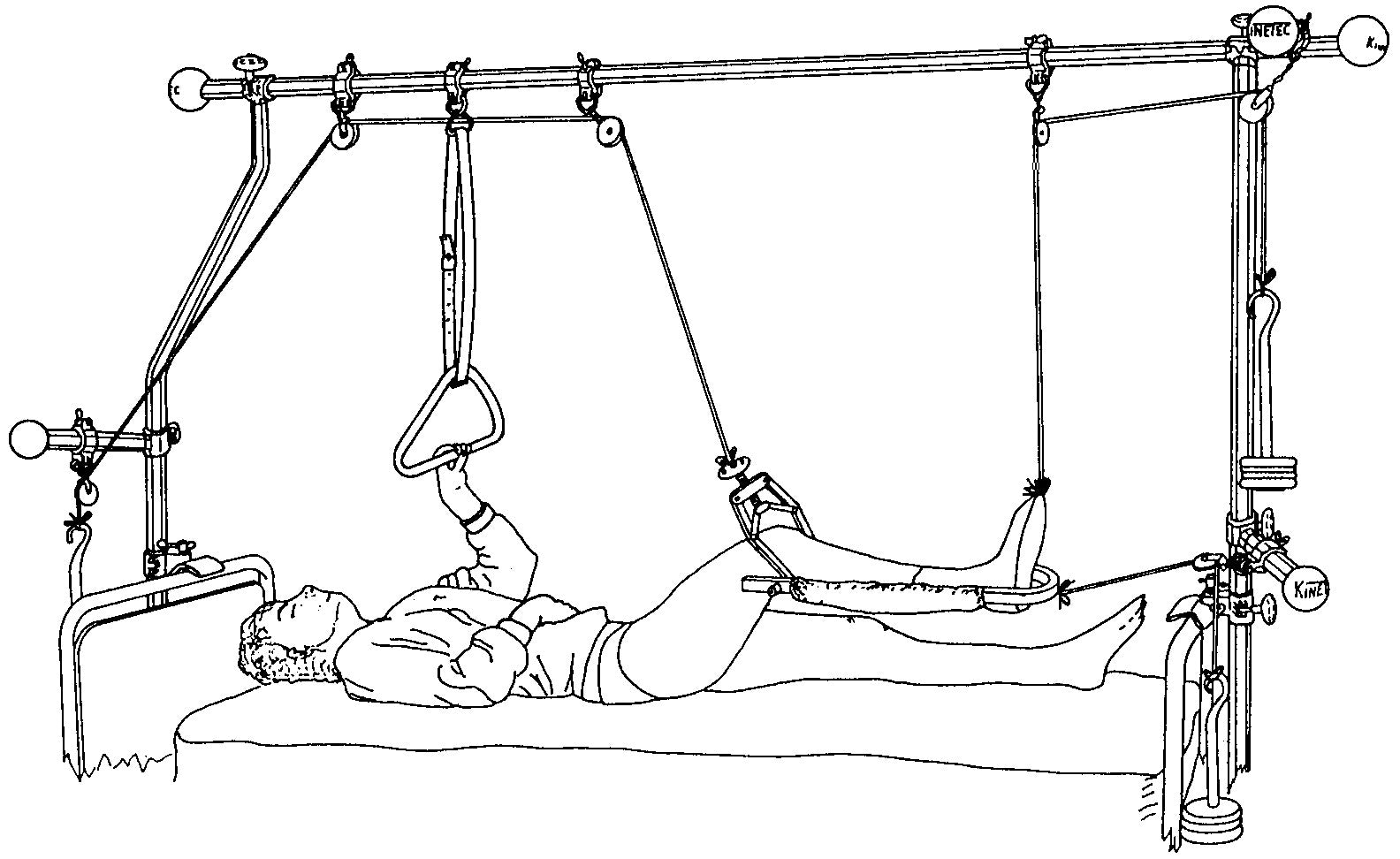 Splint 1050 with Pads (U Splint)