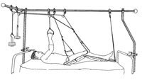 Leg Splints