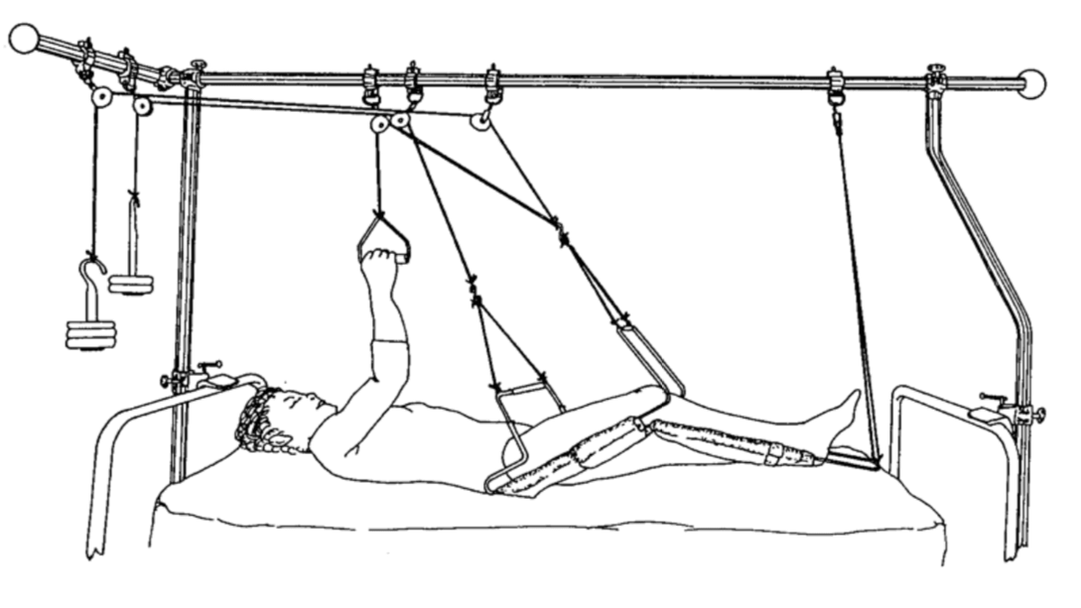 Leg Splints
