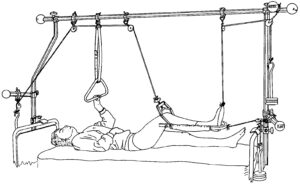 Splint 1050 with Pads (U Splint)